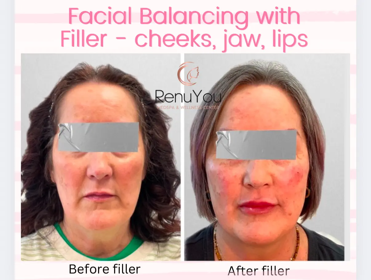 facial-balancing-ba-a-in-ames-ia