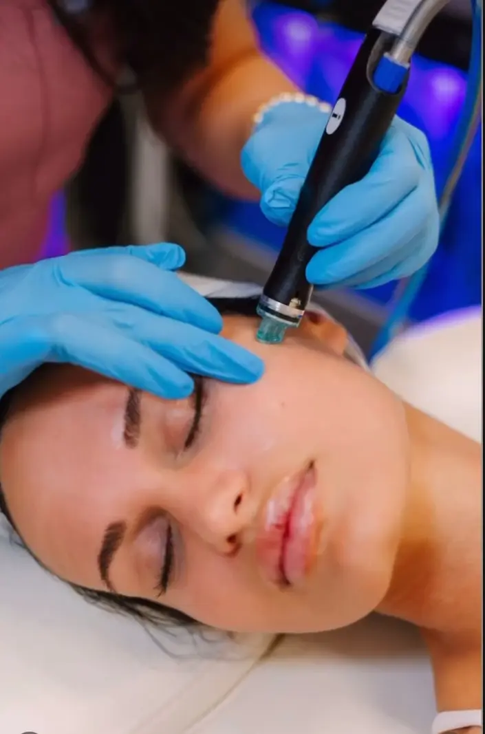 hydrafacial-procin-ames-ia