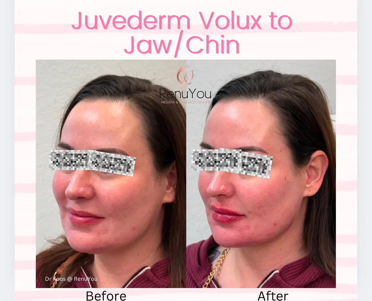 juverm-volux-ba-b-in-ames-ia