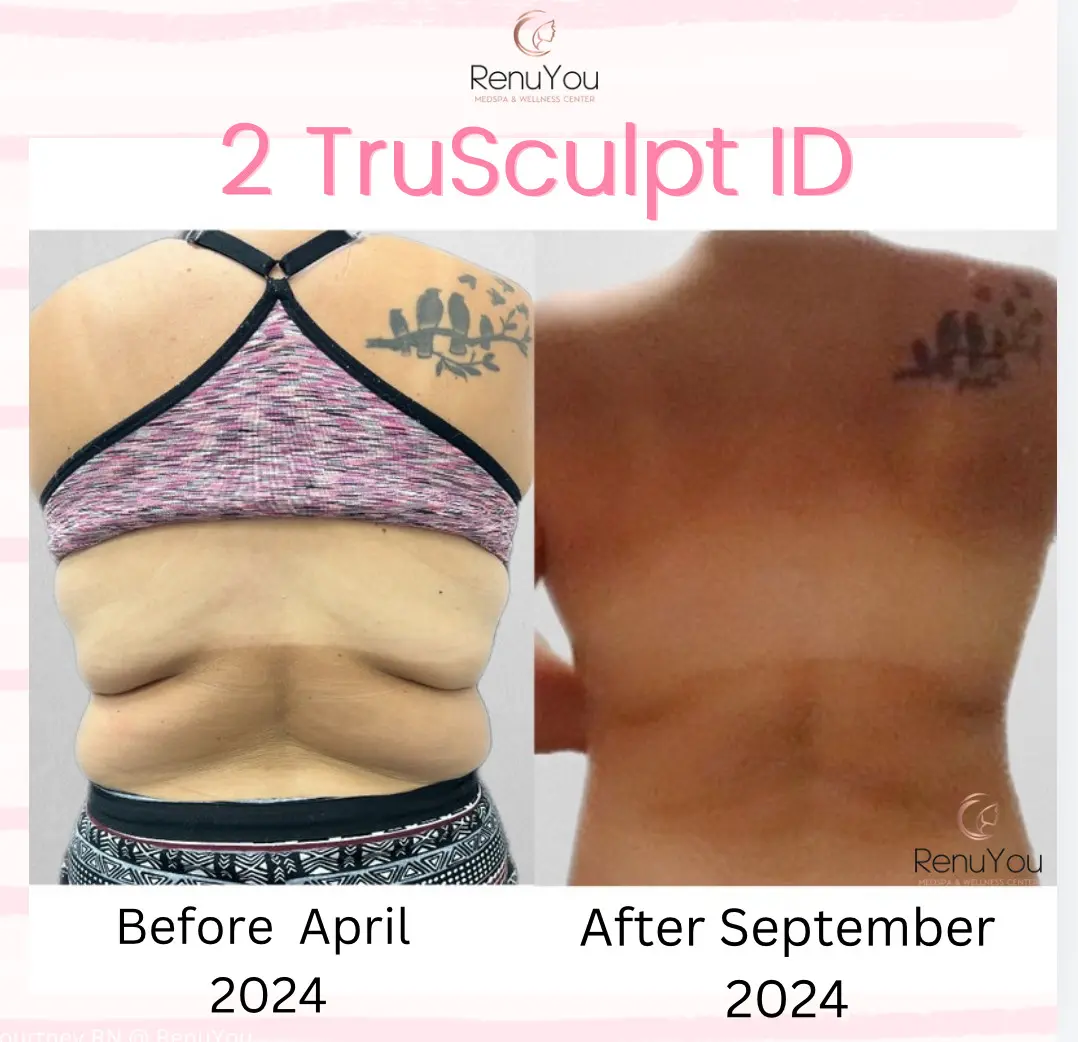 trusculpt-ba-b-in-ames-ia